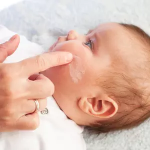Bloody hoop scherp Baby met droge huid: dit moet je wel en niet doen
